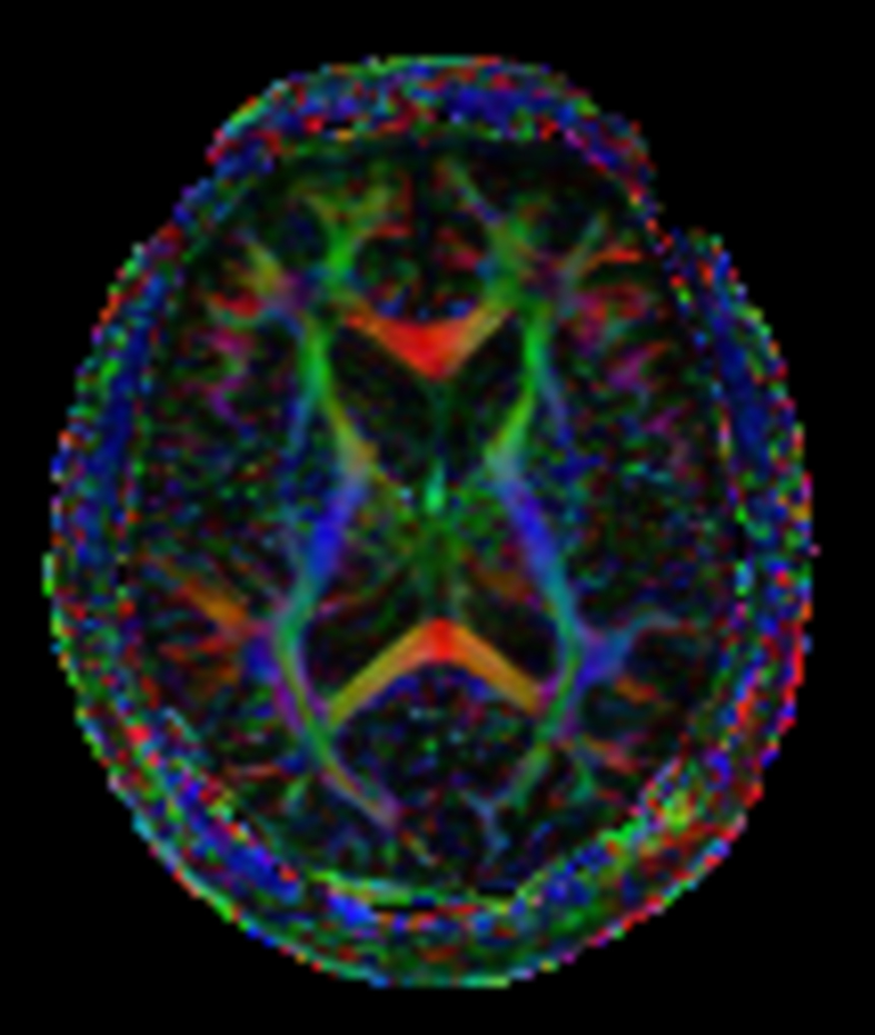 DTI b800 15 directions (FA map)